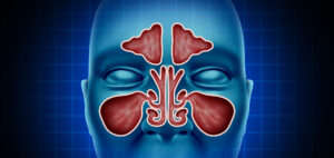 Is a sinus infection contagious